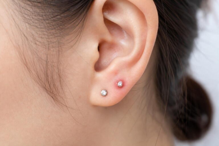 Piercing bumps